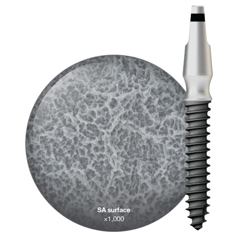MS implantát vhodný pre snímateľnú zubnú náhradu